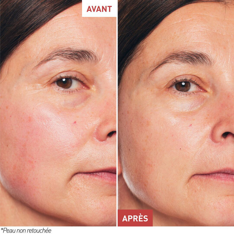 Skin Therapy – Huile-Sérum Nuit Multi-Perfectrice