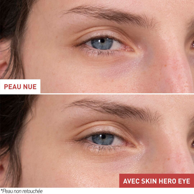 Skin Hero Eye