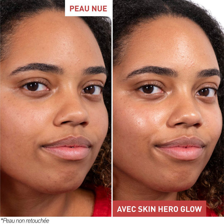 Skin Hero Glow